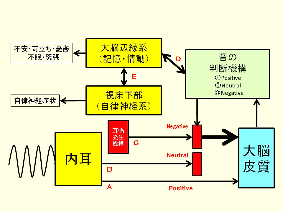 新しい耳鳴り理論①