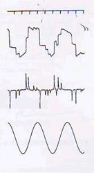 視標追跡検査