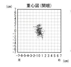 重心図（開眼時）