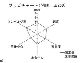 グラビチャート（開眼時）