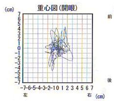 重心図（開眼）
