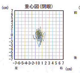 重心図（開眼）