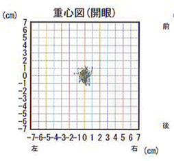 重心図（開眼）