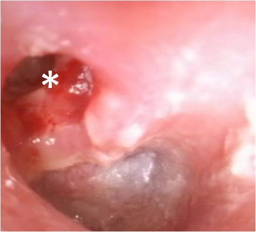 きこえの仕組みと難聴を起こす病気