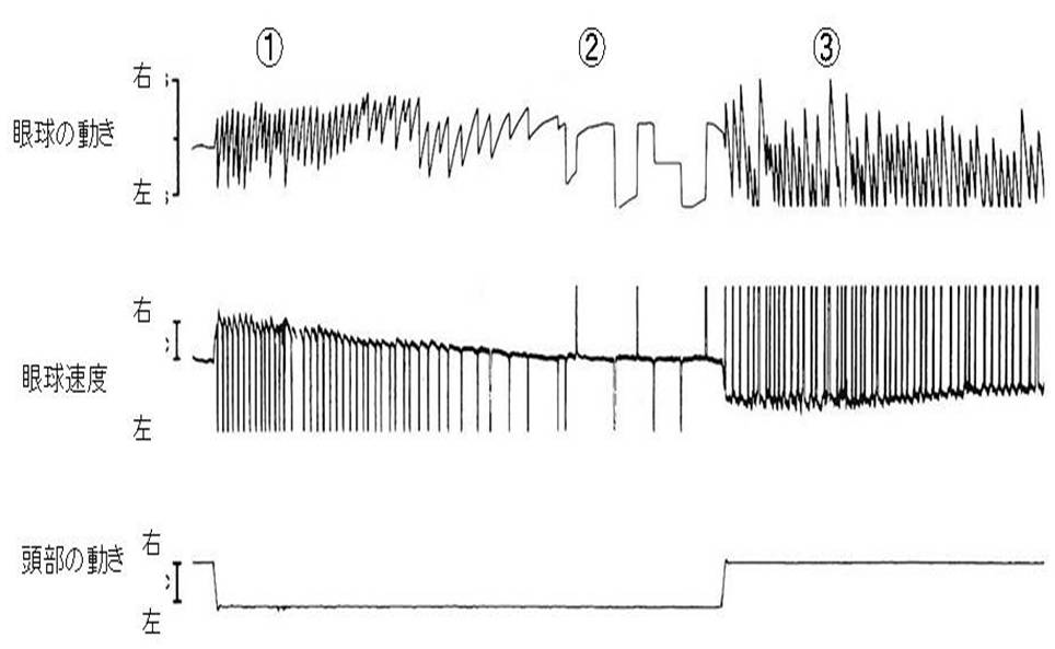 前庭動眼反射の特性